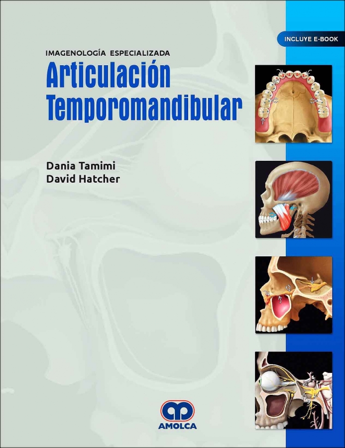 ARTICULACION TEMPOROMANDIBULAR Imagenología Especializada